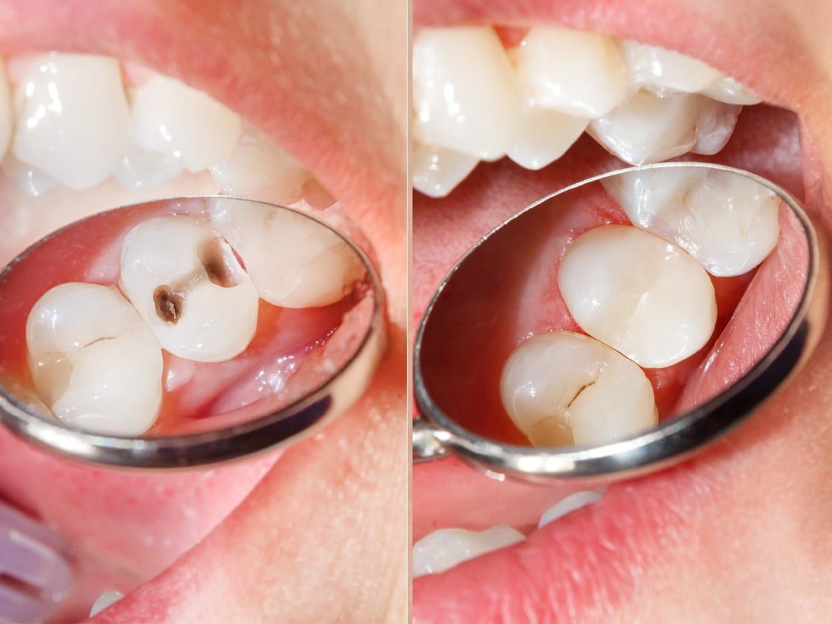 Dentist in Nairobi