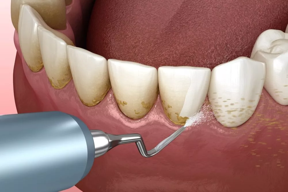 Dentist in Nairobi