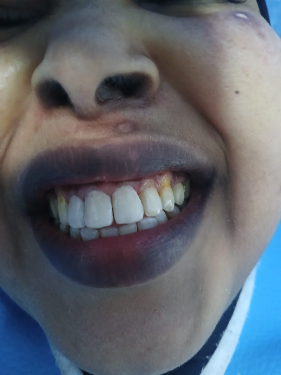 Dentist in Nairobi