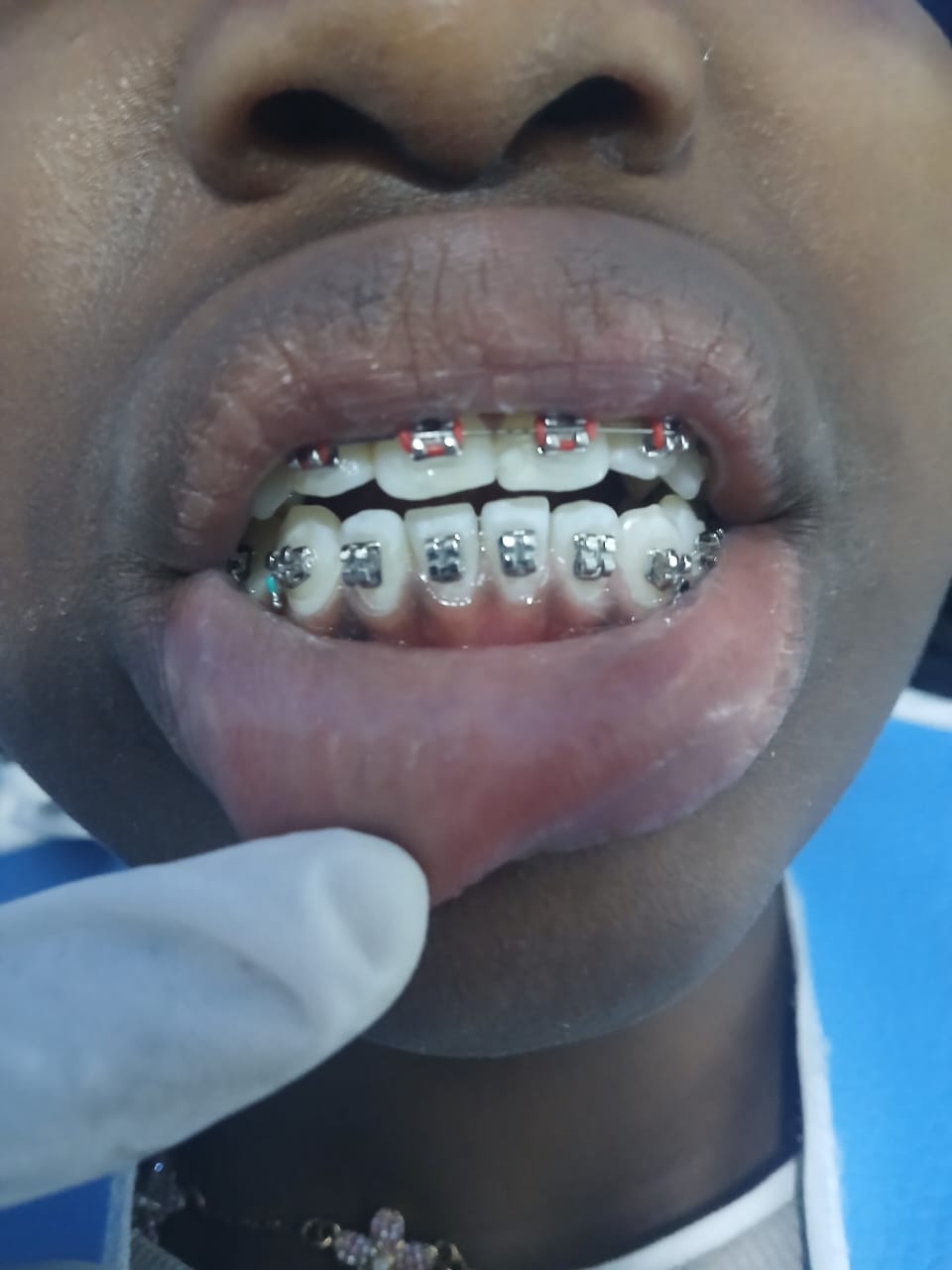 Dentist in Nairobi
